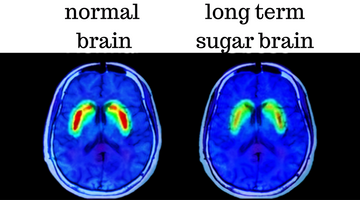 🧠 HOW SUGAR AFFECTS YOUR BRAIN 🧠
